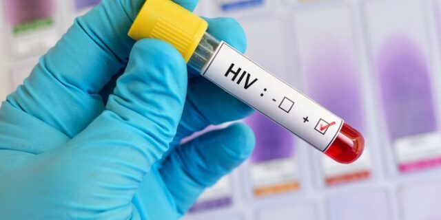 HIV: Μάλλον έχουμε τον πρώτο ασθενή στον κόσμο που θεραπεύθηκε μόνο με φάρμακα