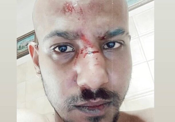 Ναύπακτος: Ομοφοβική επίθεση- Τον ξυλοκόπησαν και τον εγκατέλειψαν αιμόφυρτο