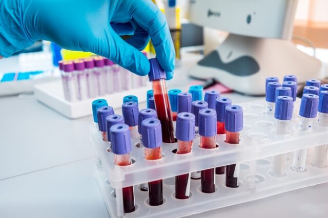 Κορονοϊός: Νέο τεστ αίματος προβλέπει την πιθανότητα διασωλήνωσης