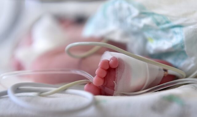 Κορονοϊός: Τι αναφέρουν οι γιατροί για το 2 μηνών βρέφος που διασωληνώθηκε