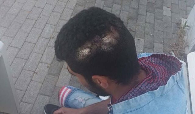 Κρήτη: Εργοδότης χτύπησε με αλυσίδα στο κεφάλι εργάτη – Τι αναφέρει ο 23χρονος Αιγύπτιος