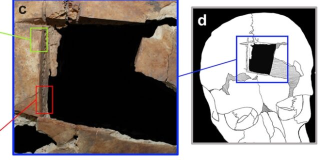 Αρχαιολόγοι ανακάλυψαν κρανίο με τετράγωνη τρύπα – Τι σημαίνει