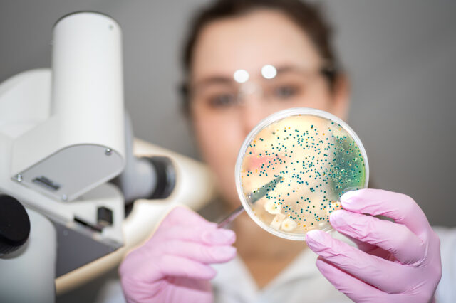 Μικροβίωμα εντέρου: Τι είναι και γιατί θεωρείται ο αόρατος καθρέφτης της υγείας μας