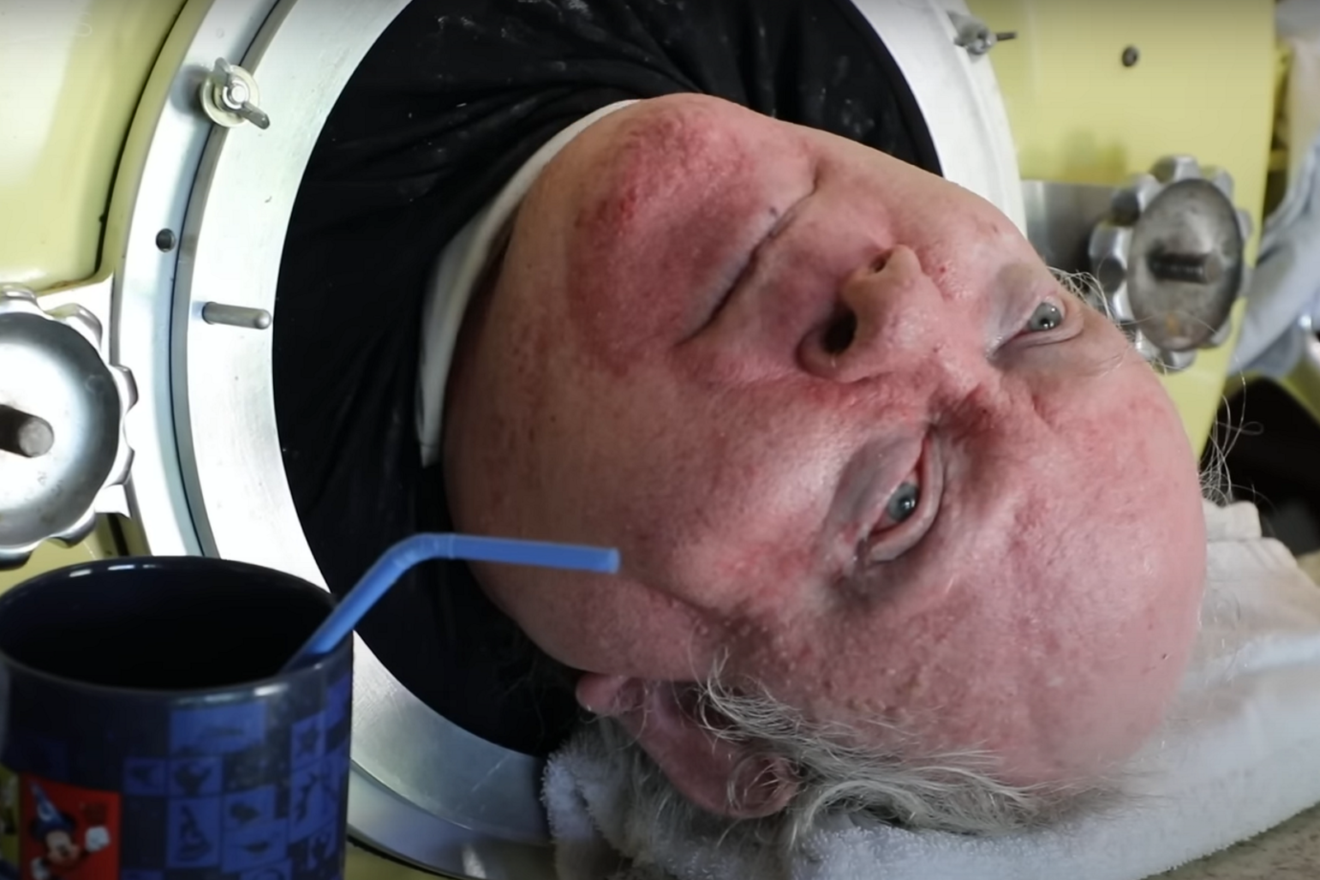 Πώς ο Polio Paul έζησε μέσα σε σιδερένιο πνεύμονα πάνω από 70 χρόνια, σπάζοντας κάθε ρεκόρ