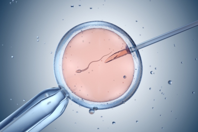 Εξέταση σπέρματος (Φωτογραφία αρχείου)