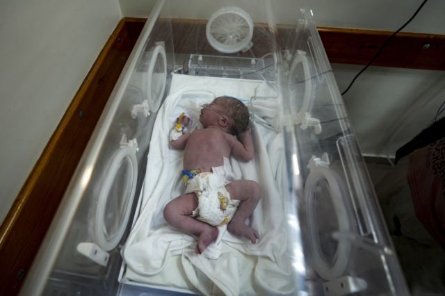 Το έμβρυο που σώθηκε στη Γάζα
