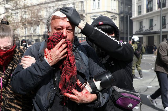 Επεισόδια στο Σύνταγμα: Τραυματίστηκε φωτορεπόρτερ από κρότου λάμψης