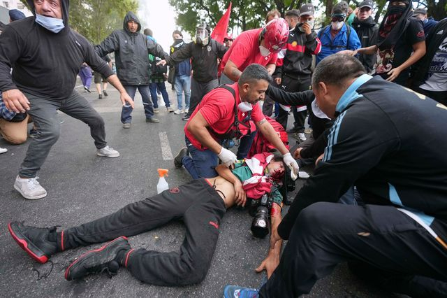 Οργή στην Αργεντινή: Φωτογράφος σε κώμα μετά από βίαιη καταστολή διαμαρτυρίας συνταξιούχων